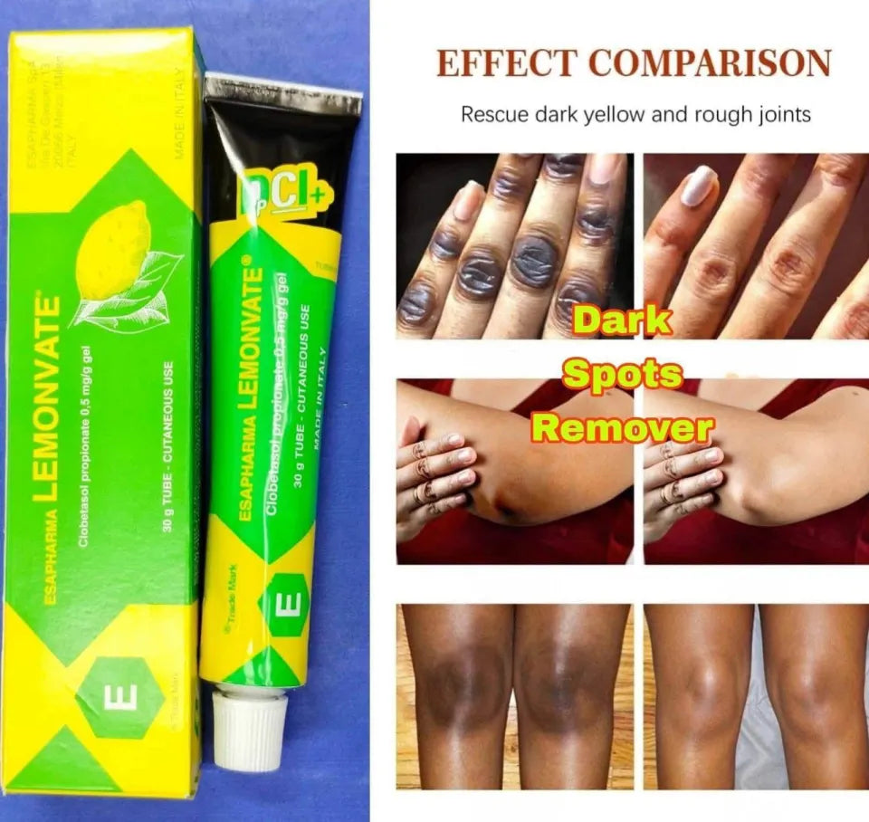 Lemonvate Cream - 30gm (Italy)
