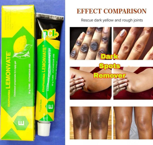 Lemonvate Cream - 30gm (Italy)
